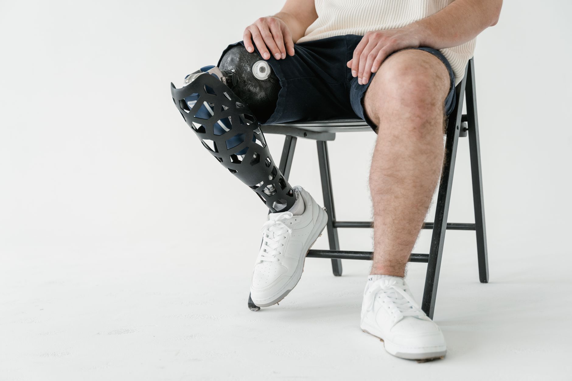 Man seated in studio wearing white sneakers, showing a below-knee prosthetic leg.