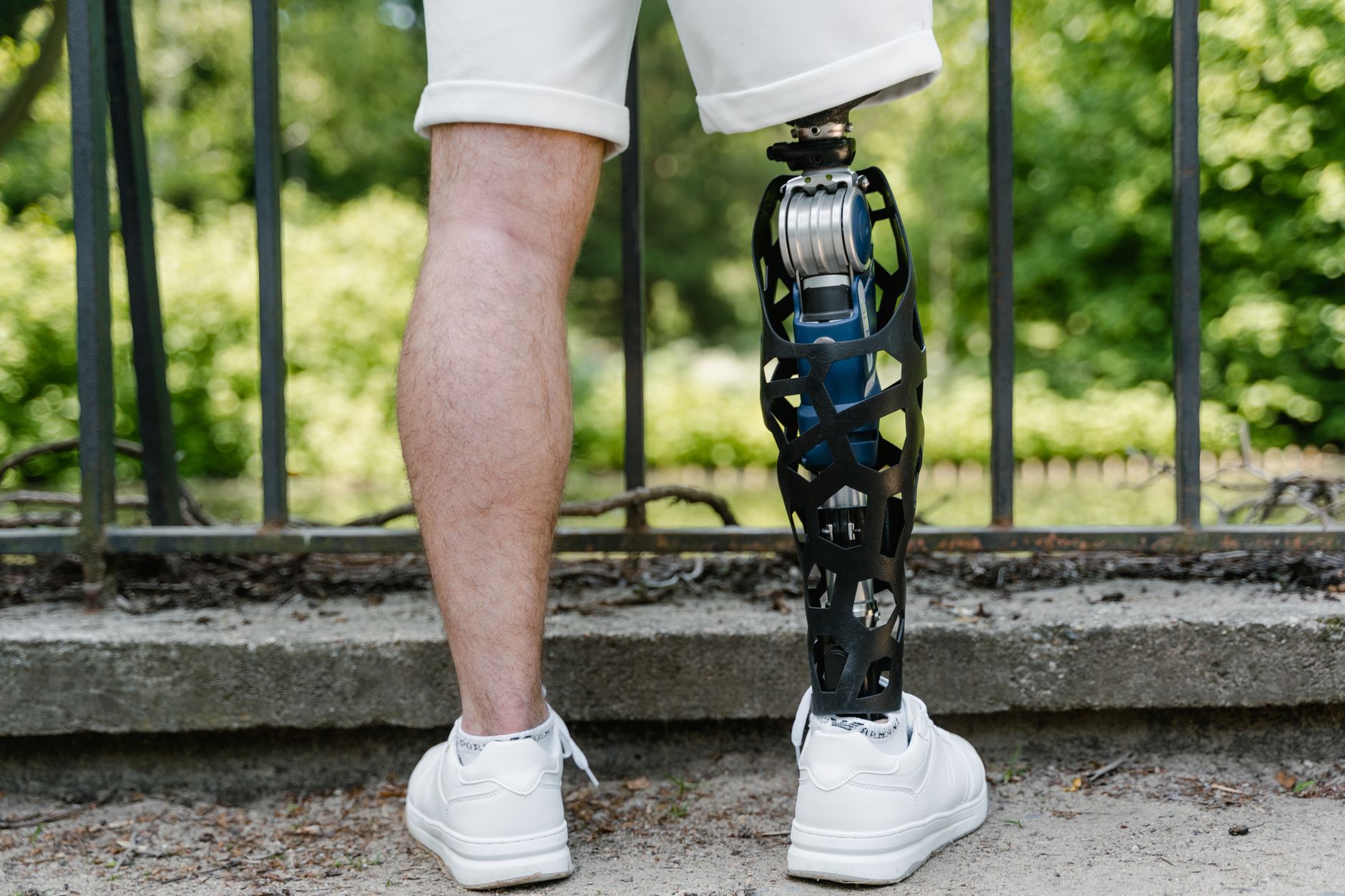a person with limb loss confidently practicing everyday mobility with a prosthetic leg
