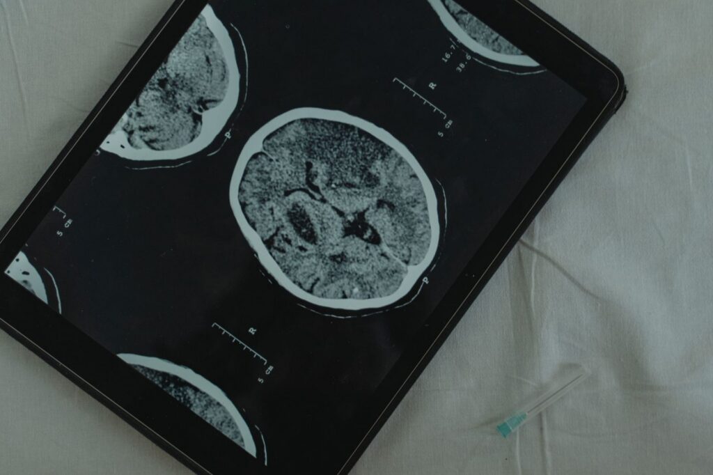 Brain CT scan on tablet with medical needle for neurological assessment.