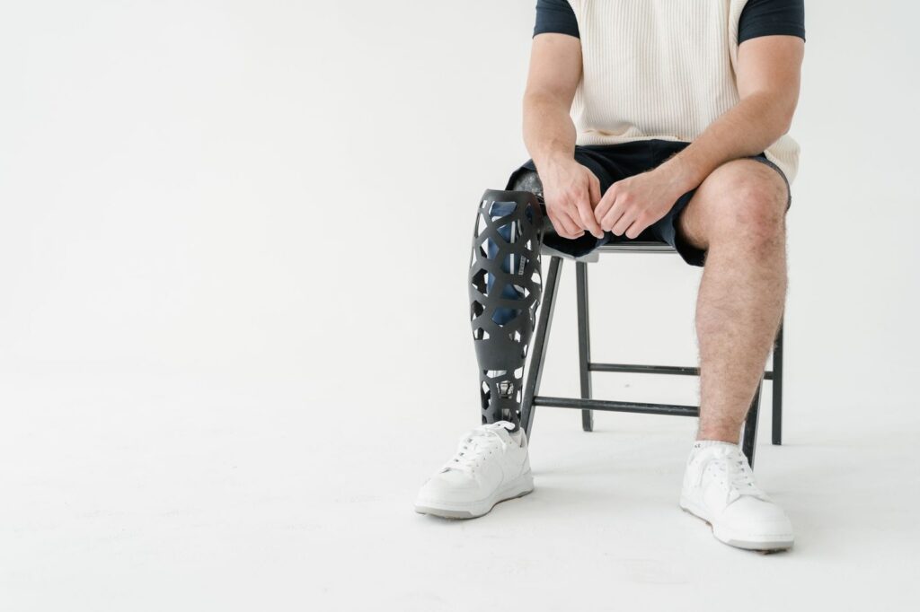 a person rebuilding daily independence with a prosthetic limb after an amputation