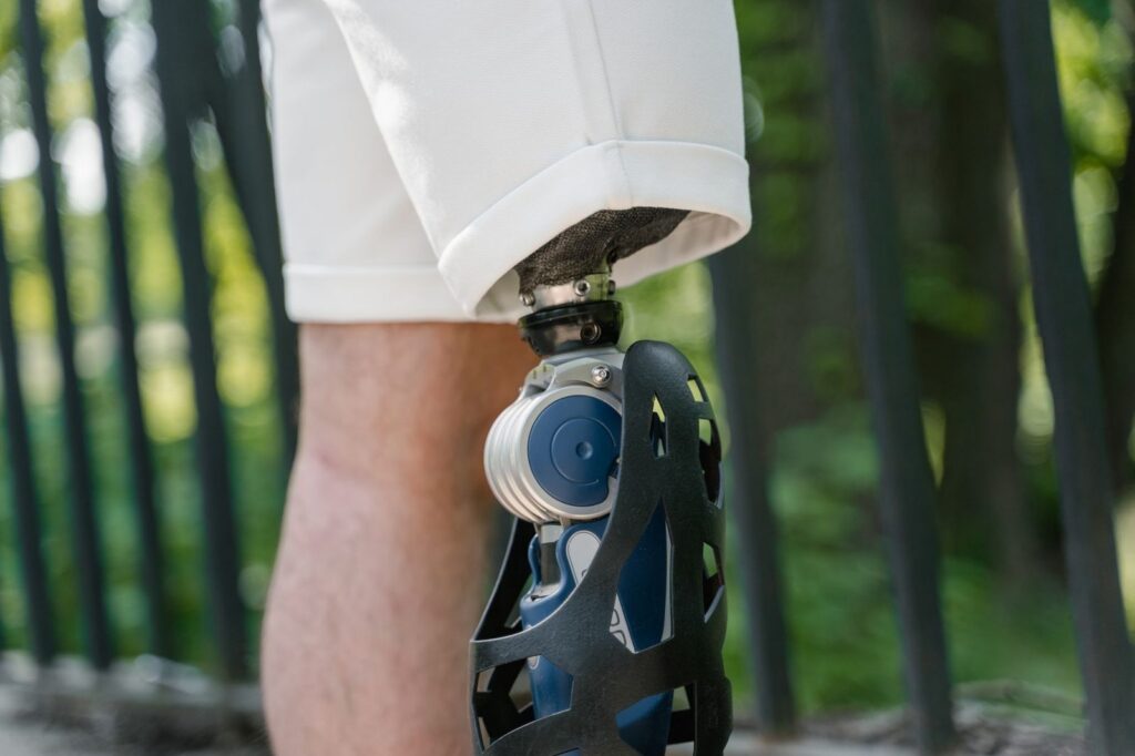 Modern prosthetic leg with advanced technology components.
