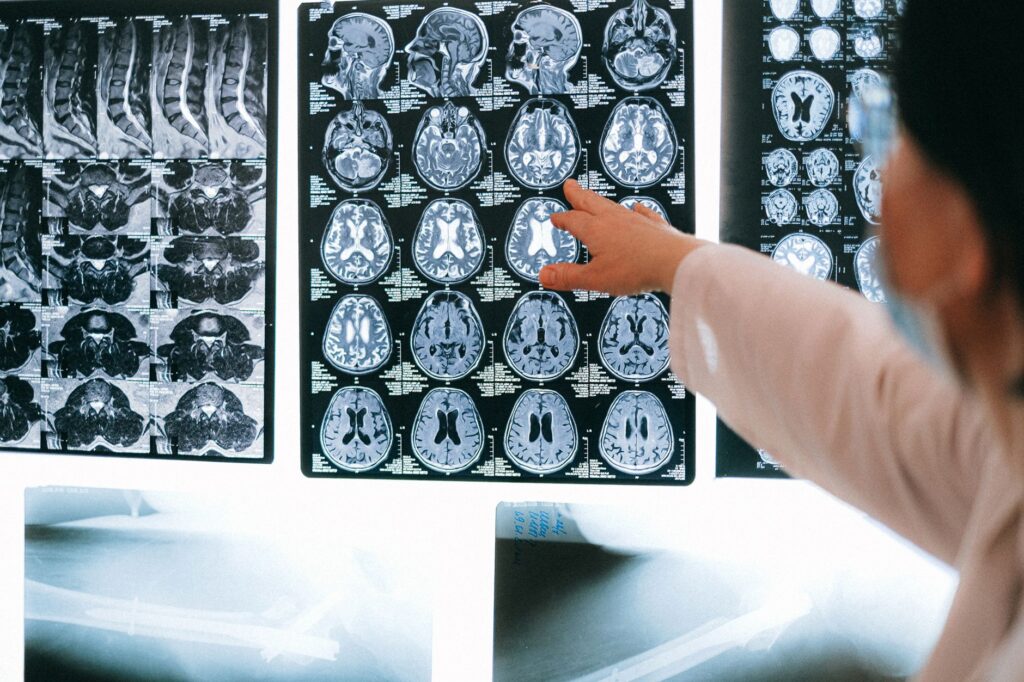 Radiologist pointing to a brain MRI scan during a detailed medical examination.