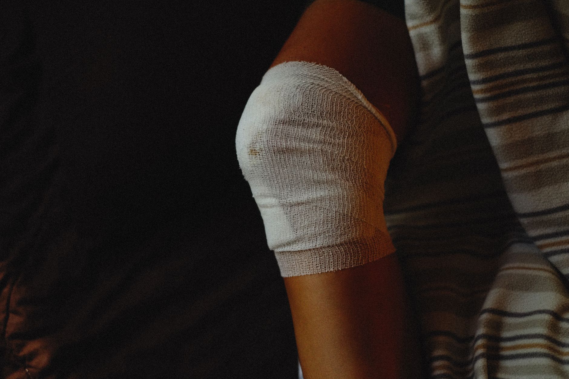 Rodilla vendada tras una lesión, mostrando el proceso de cuidado y curación de quemaduras.