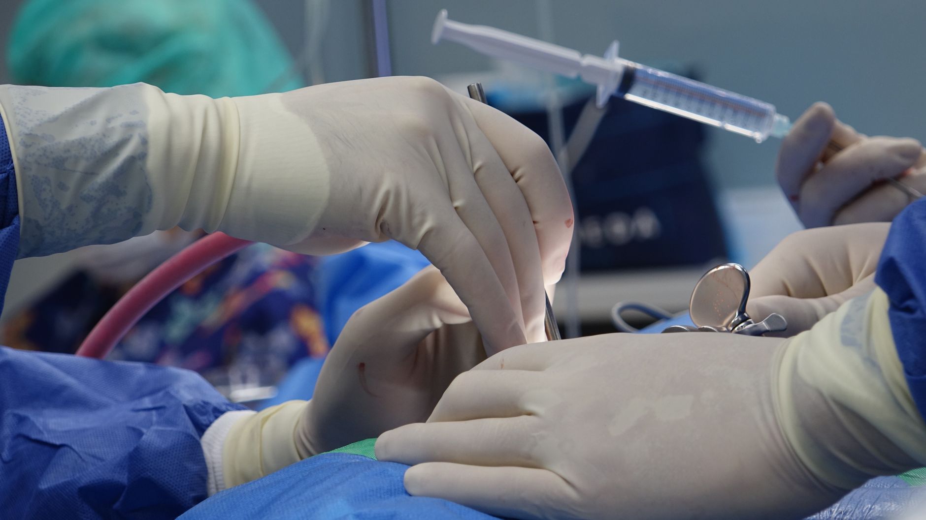 Surgeons' hands using a syringe and surgical tools during a procedure in a sterile operating room.