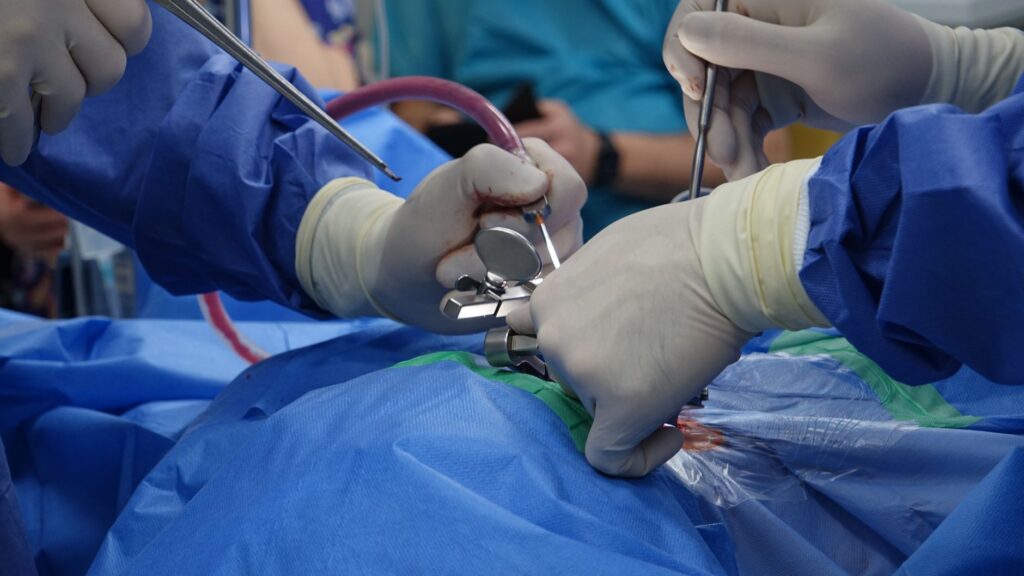 Surgeons in sterile gloves perform precise spinal surgery in a modern operating room.