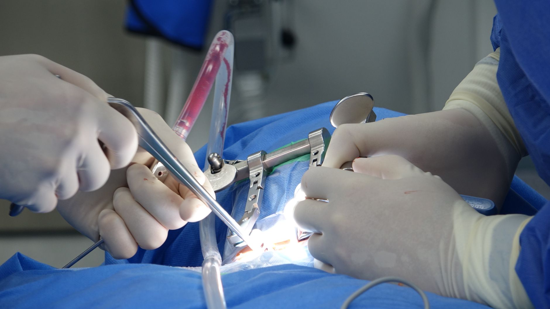 Surgeons performing spinal surgery in an operating room using precise tools and sterile equipment.