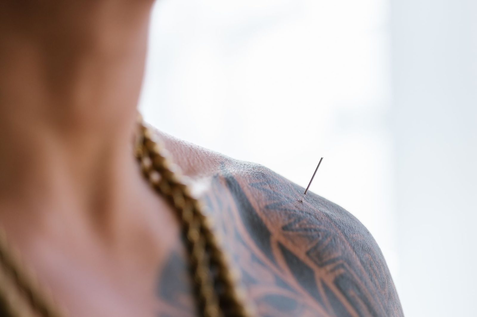 Acupuncture needle inserted into tattooed shoulder during treatment session.