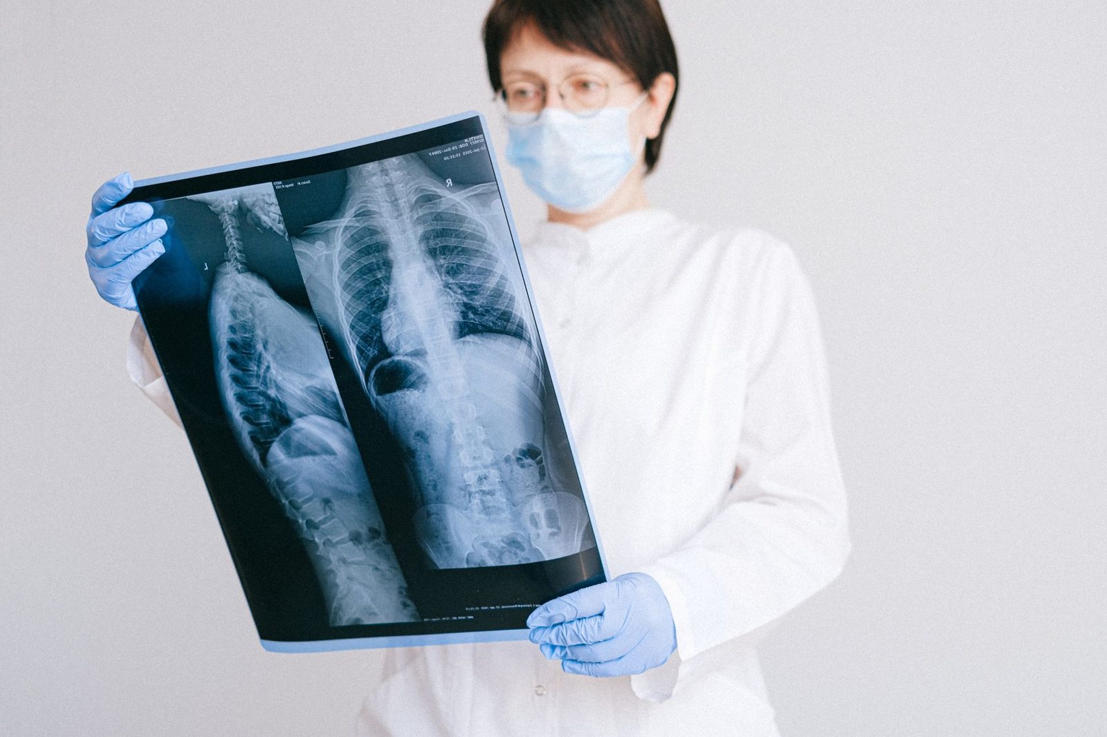 Doctor in protective gear reviewing an X-ray film in a hospital room.