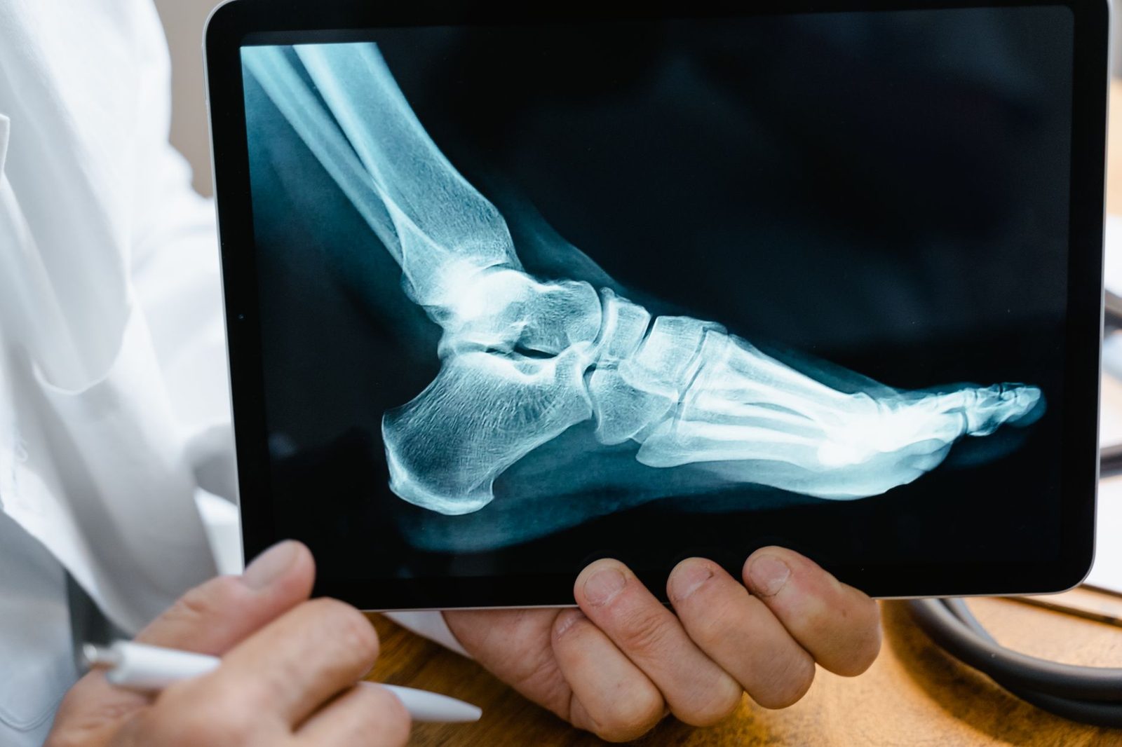 Médico revisa radiografía de pie en tableta digital durante consulta médica.