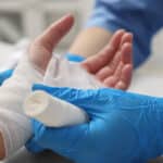 Miami Burn Injury Lawyers - CHG Lawyer